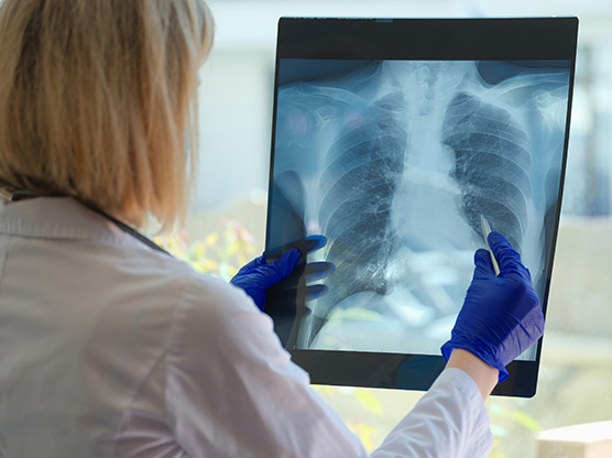 慢性閉塞性肺疾患(COPD)の検査