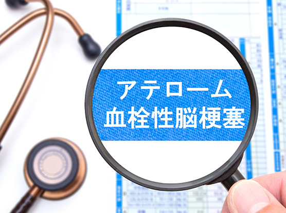 アテローム血栓性脳梗塞