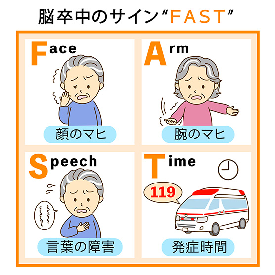チェックリスト「FAST」